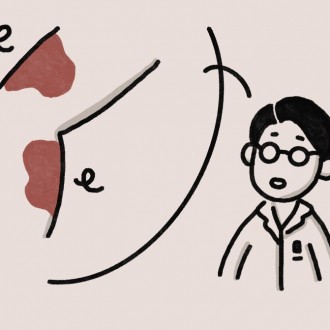 피부질환 건선