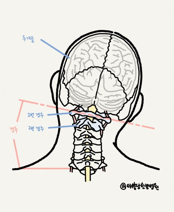 턱관절 장애