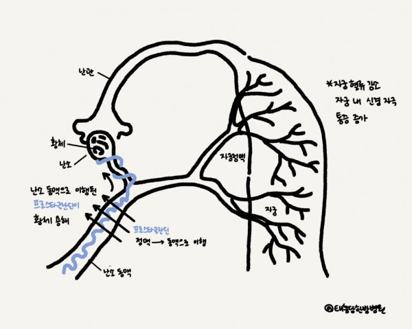 생리통 월경통