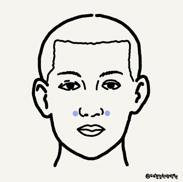 비염