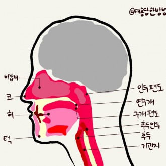 불면증
