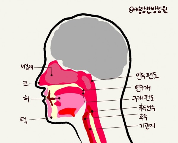 불면증
