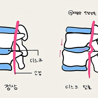 목디스크
