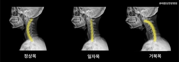 목디스크