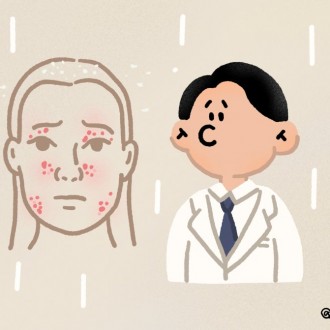 지루성 피부염