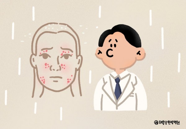지루성 피부염