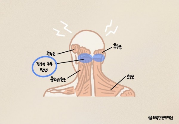긴장성 두통 