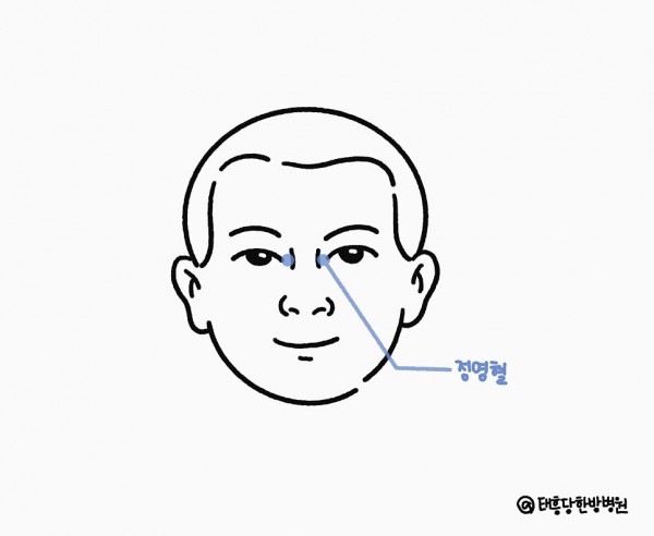 정명혈