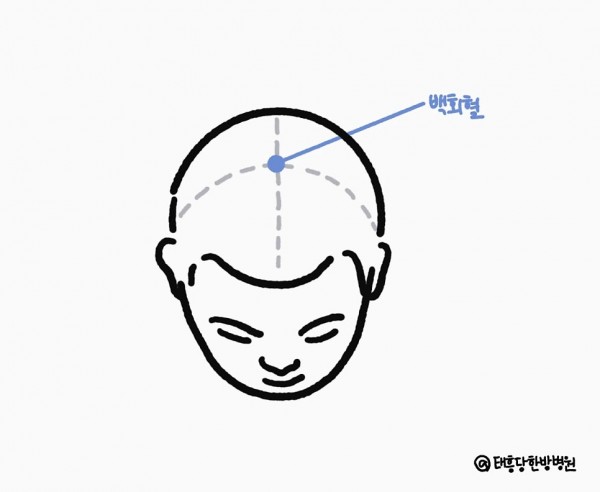 백회혈
