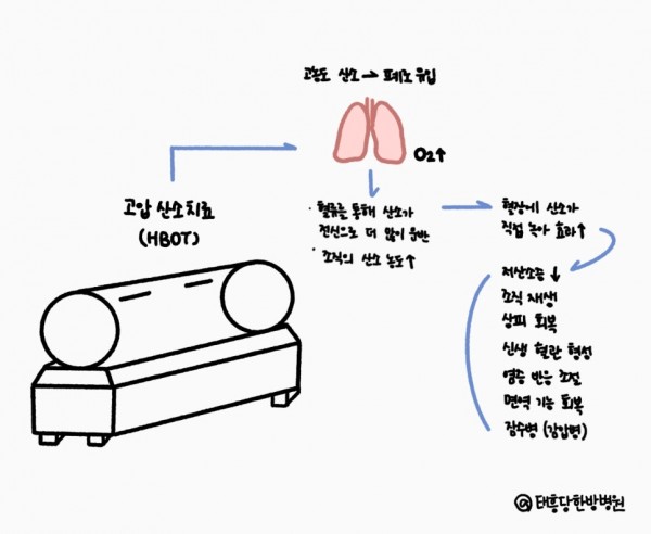 고압산소치료