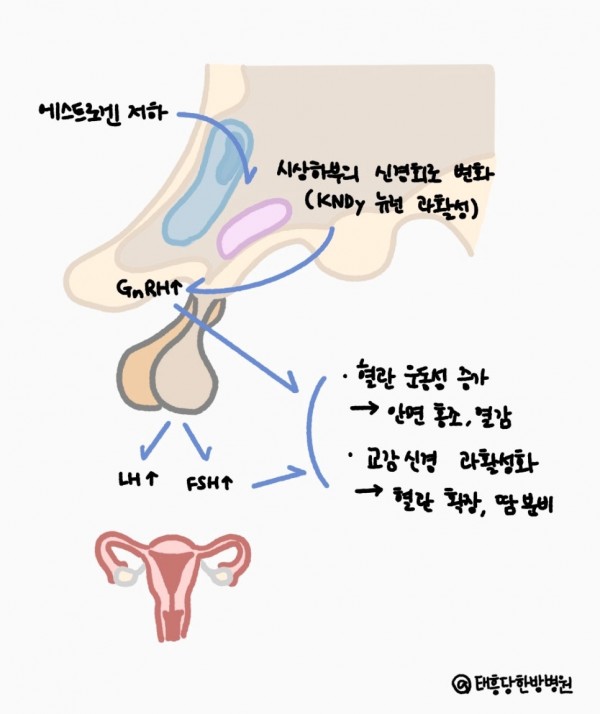 갱년기 안면홍조 열감