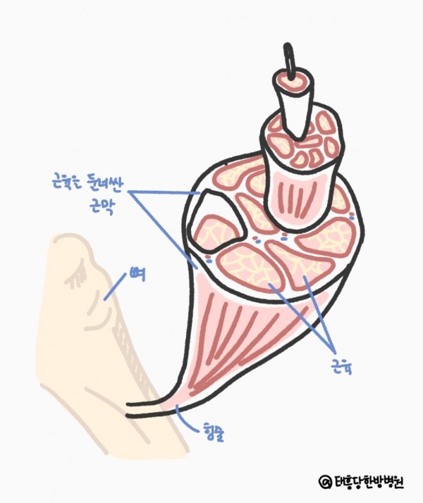 근막