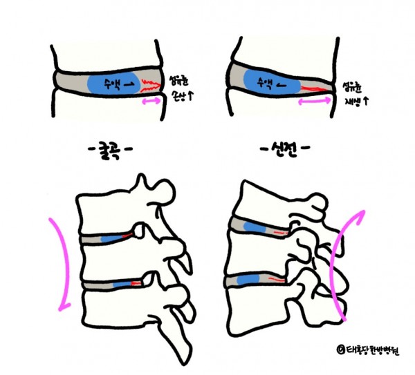 맥켄지 신전 운동